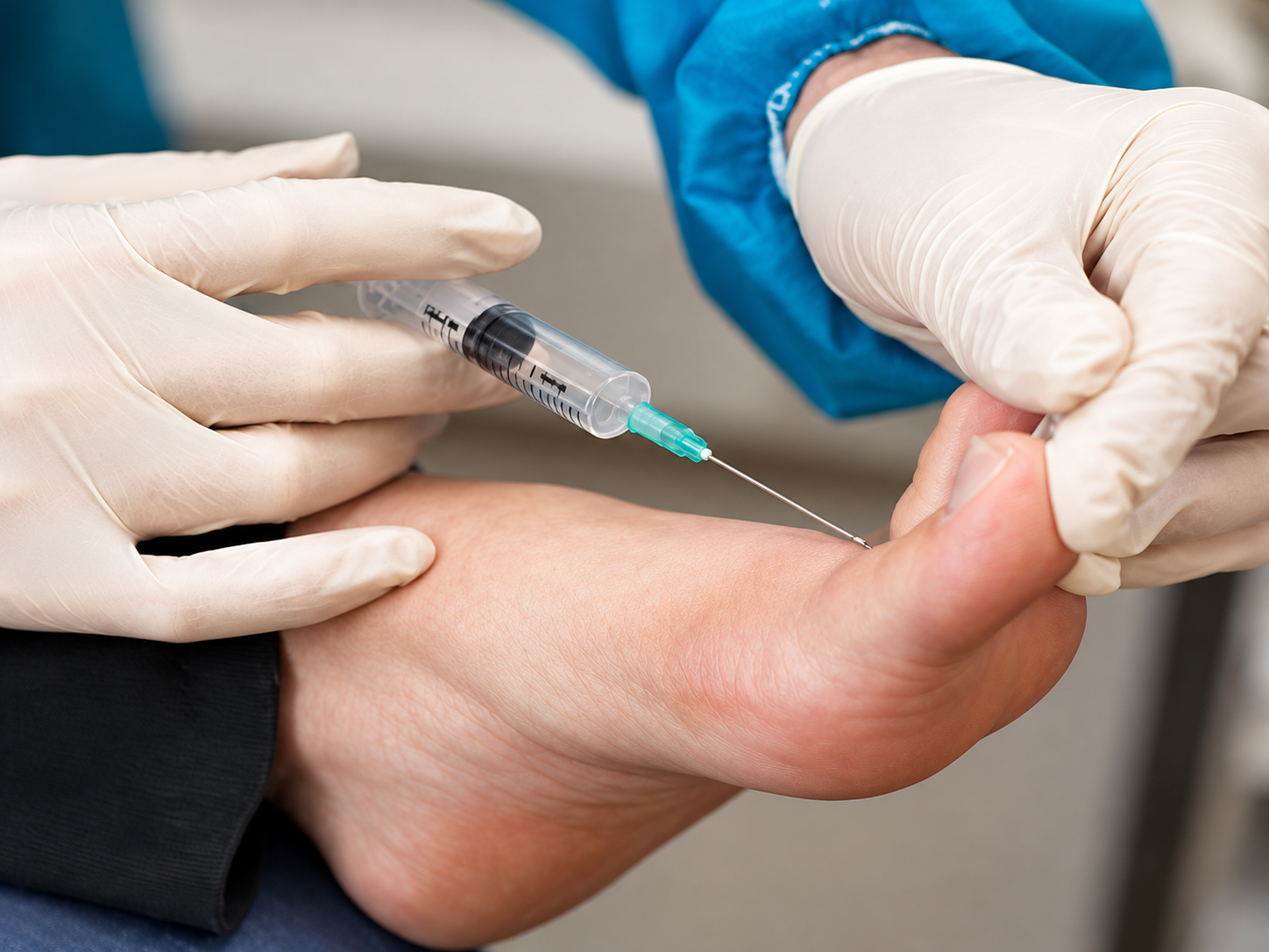 Local anaesthetic being administered before nail surgery
